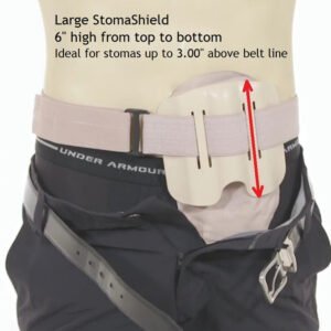 Stoma Shield